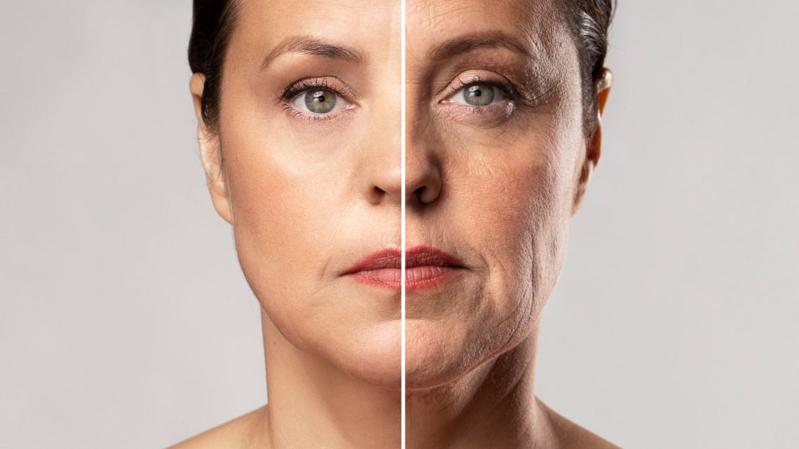 botox ou preenchimento
