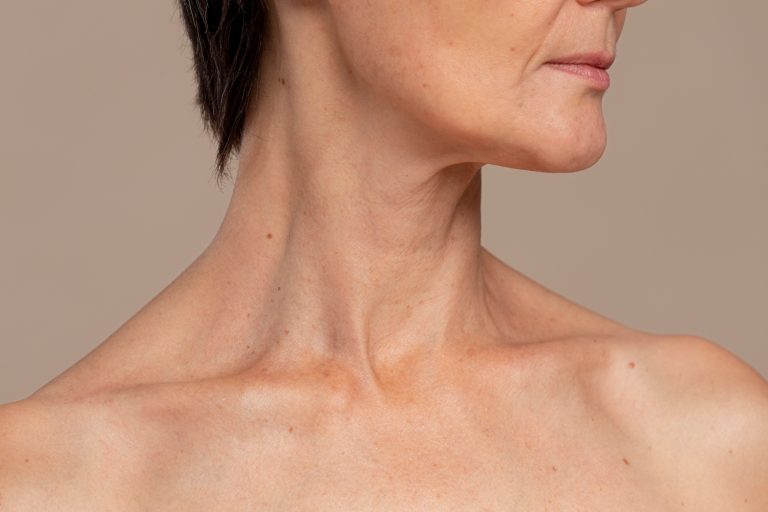 lipo de papada sem cirurgia